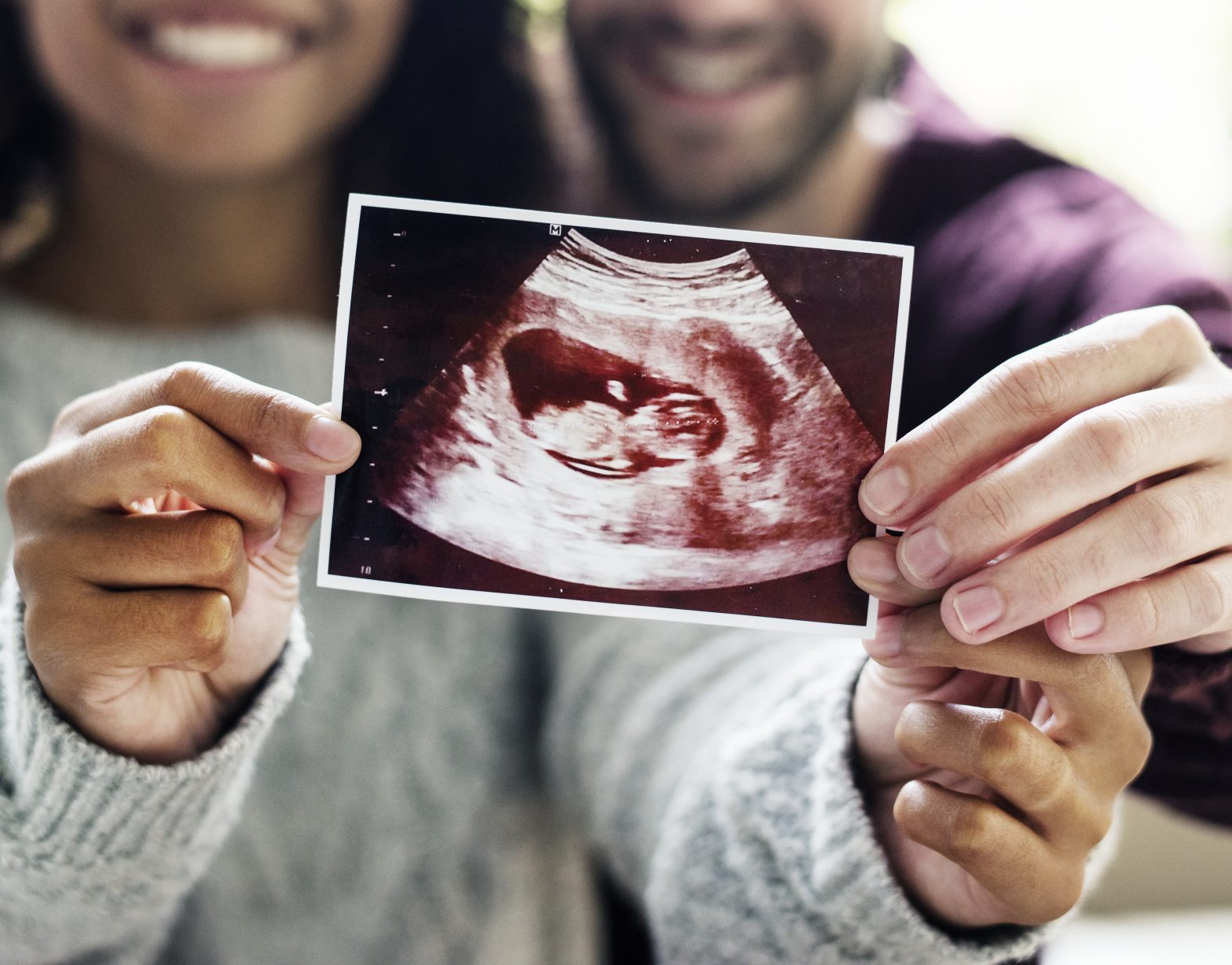 a man and woman holding an ultrasound picture
